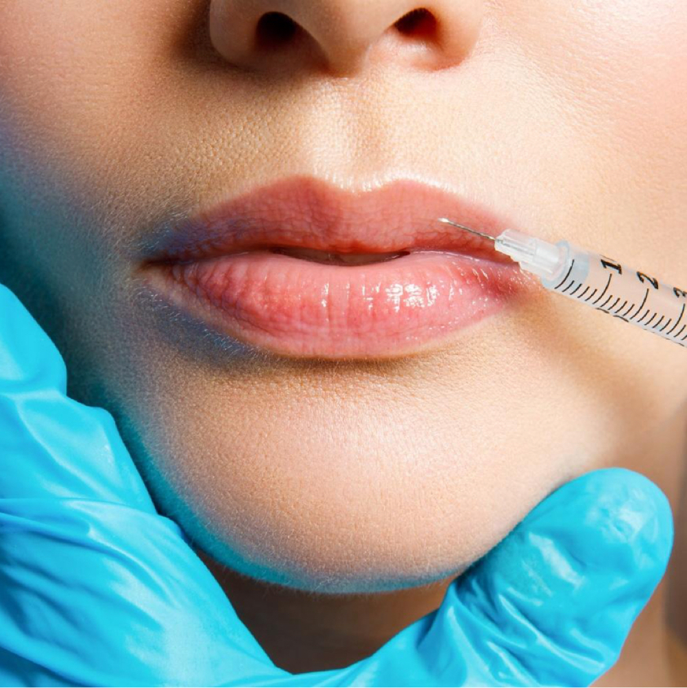 Juvederm Ultra XC at Dinah Manalo, NP - Aesthetic Medicine in Yakima, WA