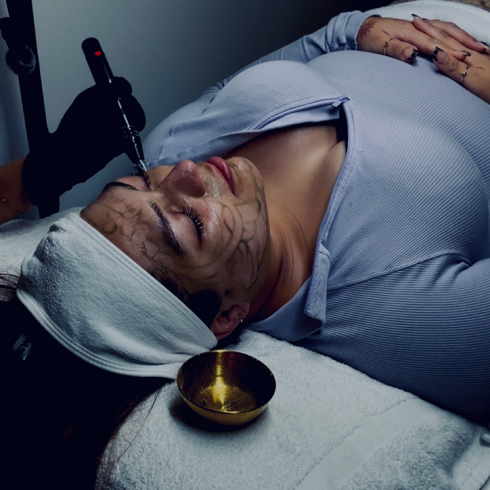 Nano Infusion Add-on at Welcome to Skin Beauty Aesthetics. in Wilson, NC
