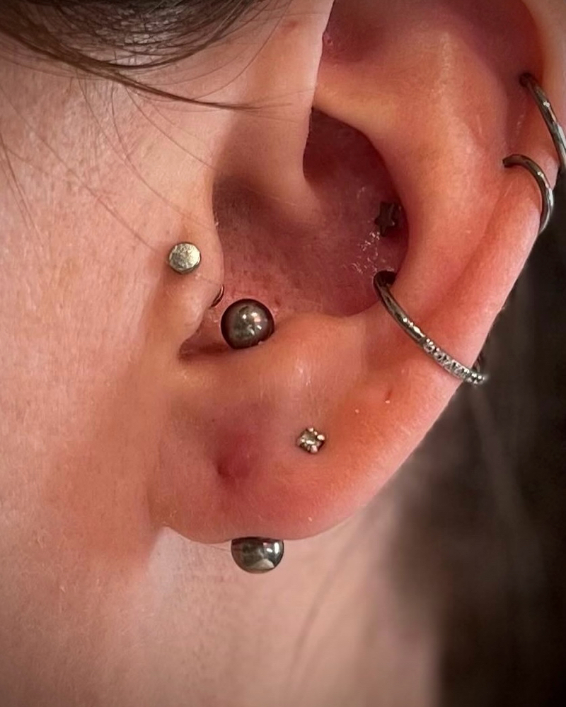 Ear Other