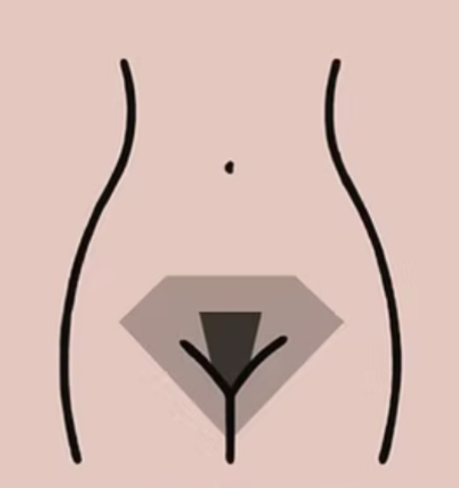 Bikini Full Treatment