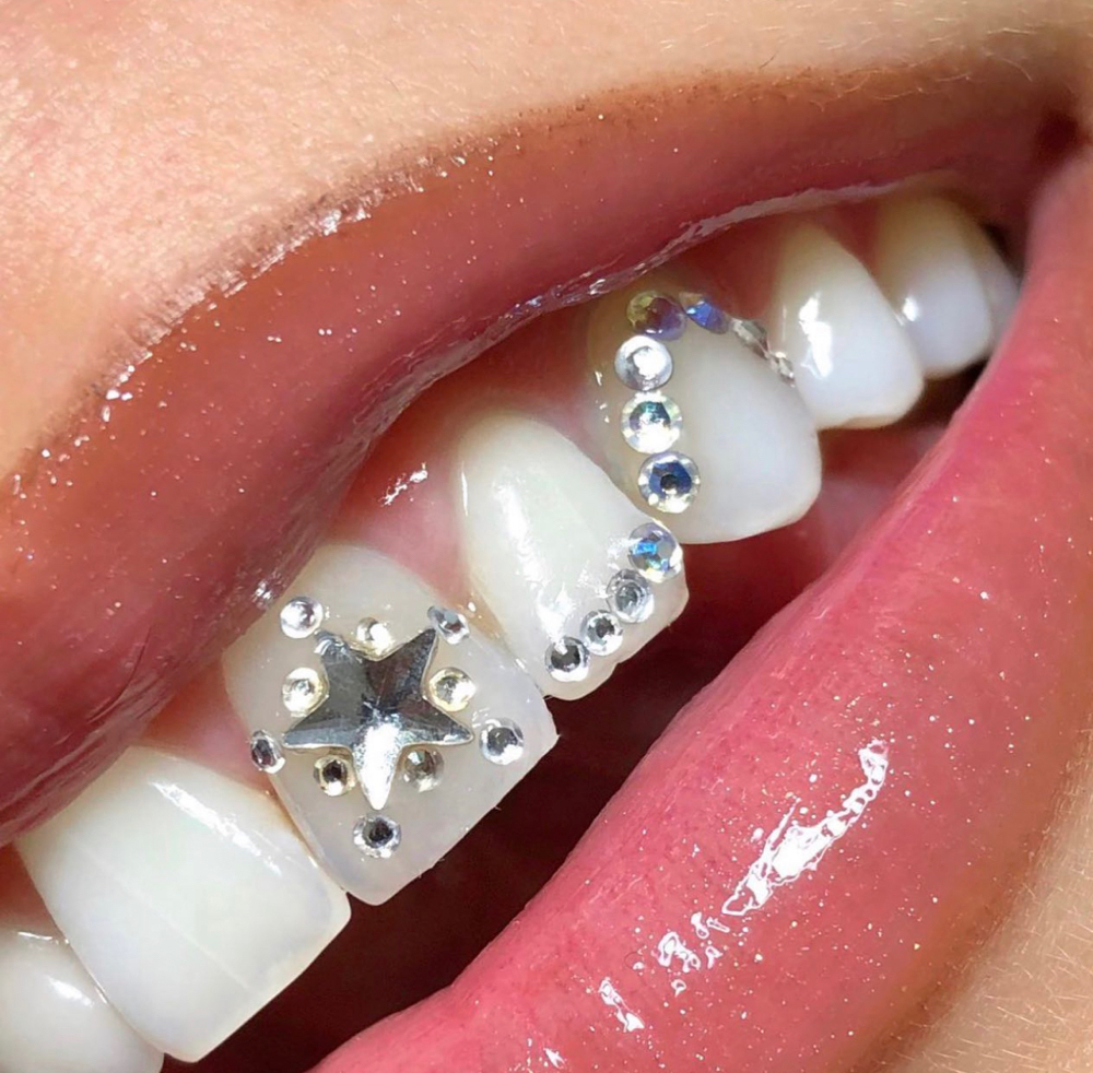 Tooth Gem - design