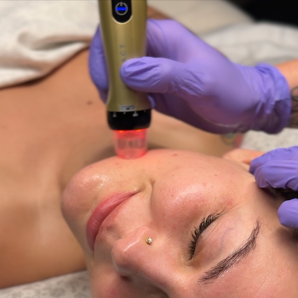 Nano Infusion 60 Minute Facial