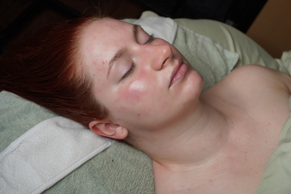 Hydrating Lactic Acid Peel Facial