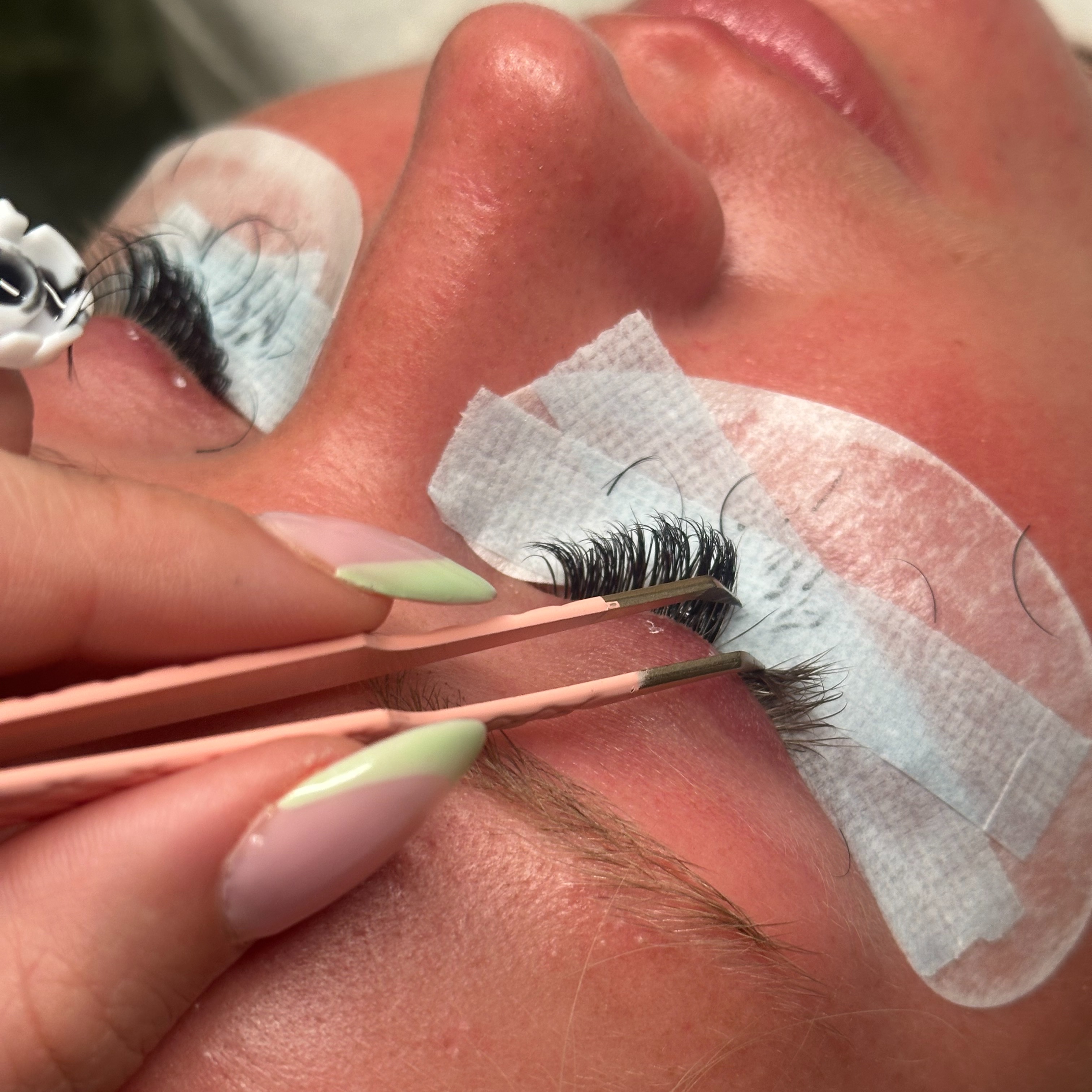 Mini Fill at Mari Esthetics in Longview, TX