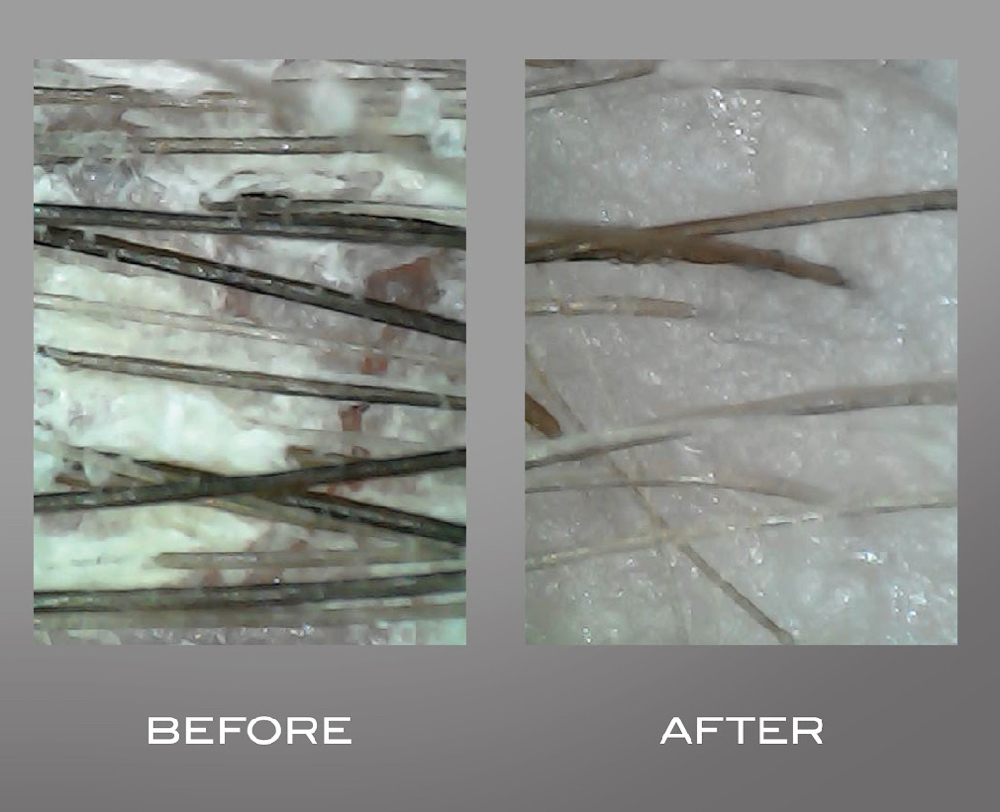 New! Scalp Detox