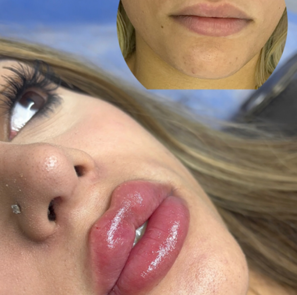 Russian/Dollfaced 2ML at Beautique J in Dorchester, MA