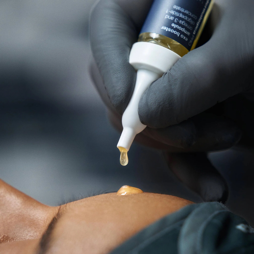 Golden Renewal Microneedle