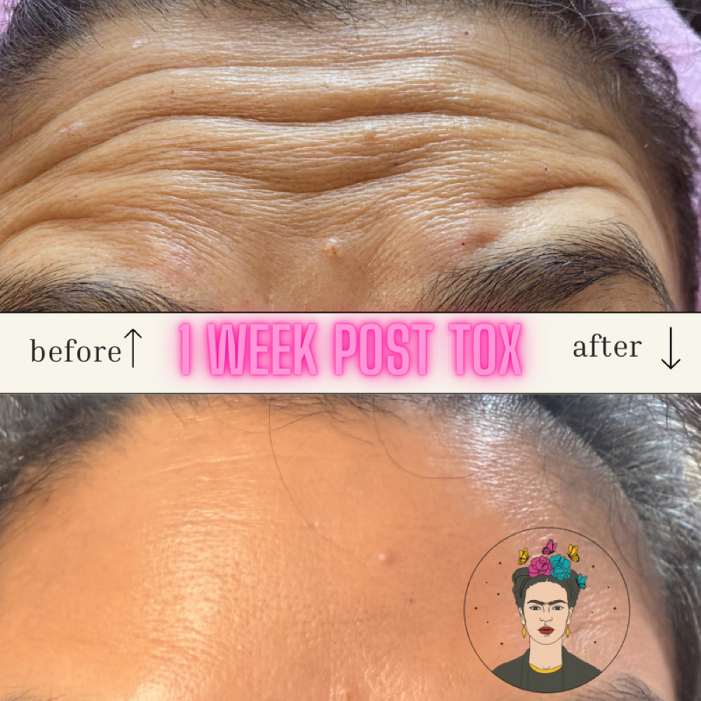 Tox Injections at Booking site for Mely & Kaila in Lubbock, TX