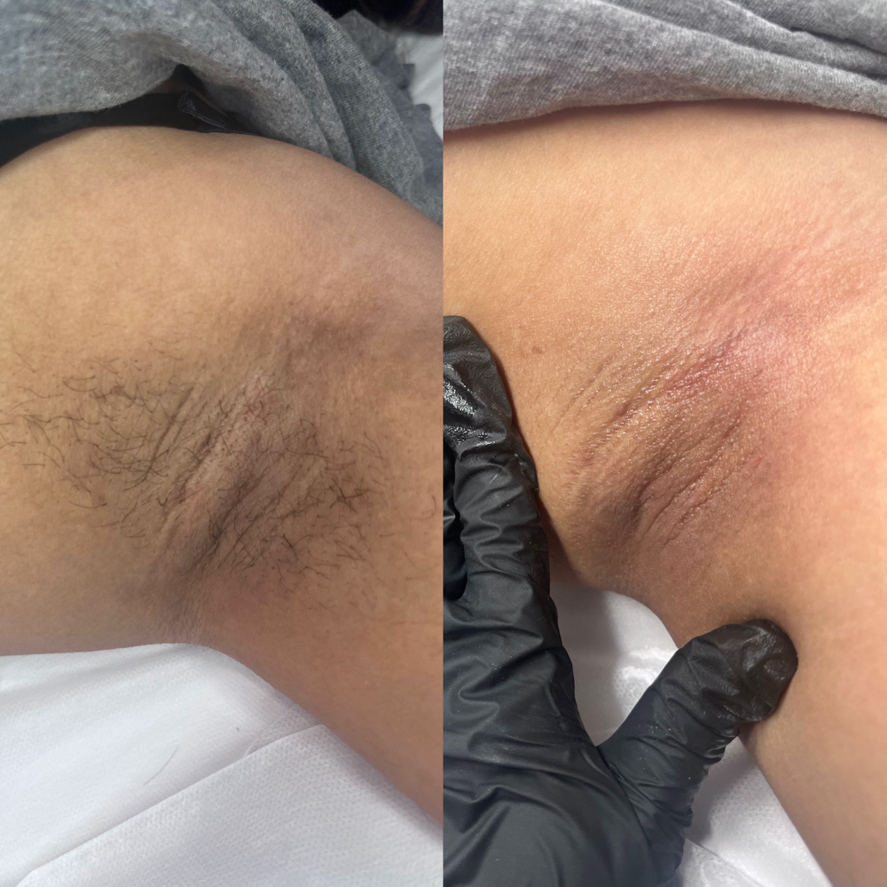 Underarm at Pure Luxe Wax Studio in Reedley, CA