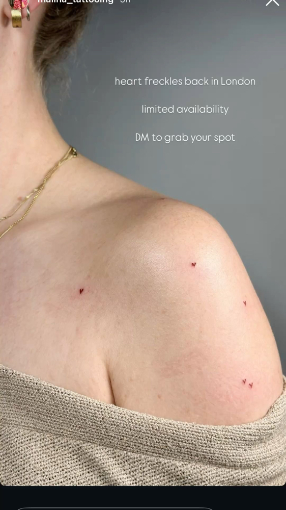 Heart Freckles