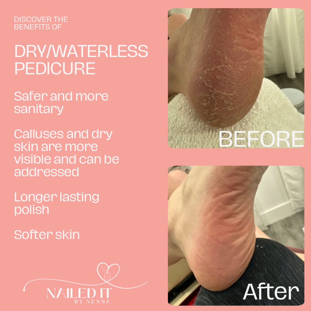 Restore Waterless Gel Pedicure