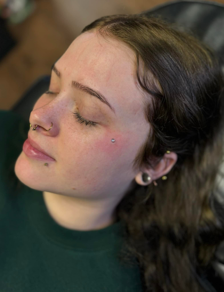 Dermal