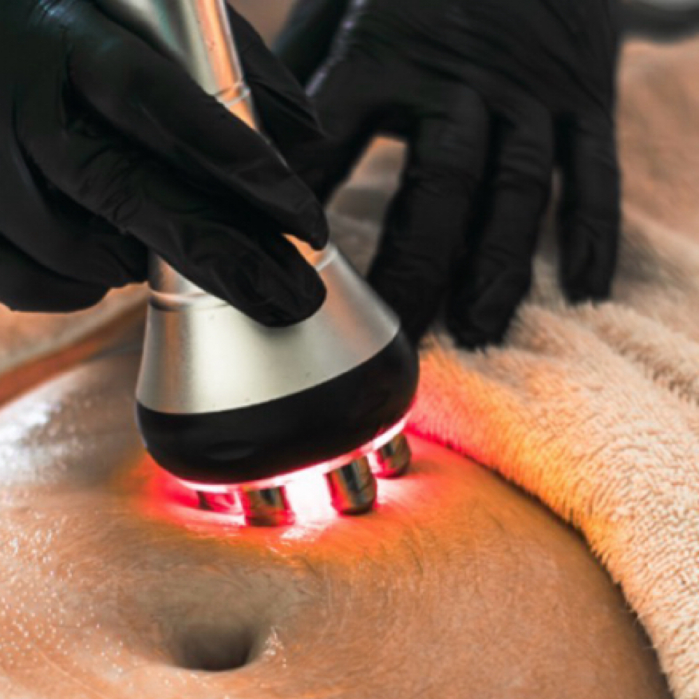 Ultrasonic Cavitation at BLAZEBODYSPA & BEAUTY BAR in TINLEY PARK, IL