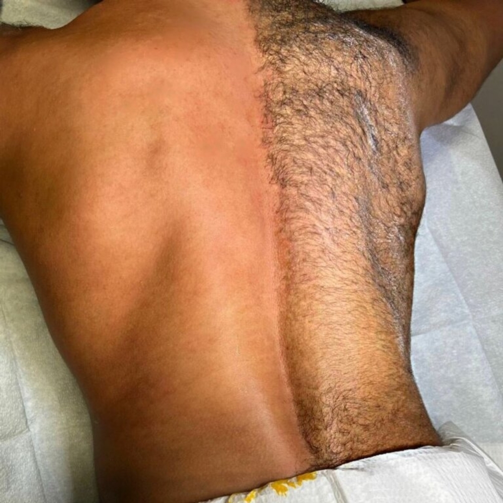Back Wax
