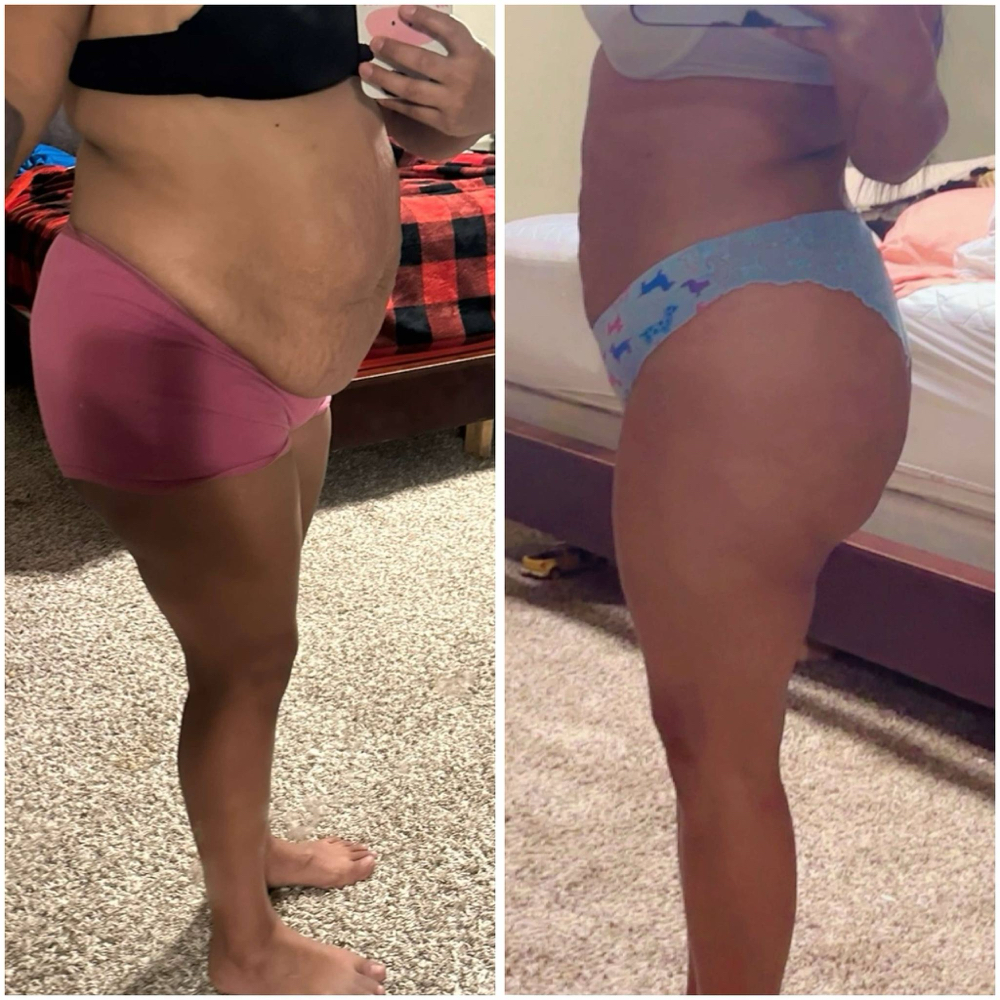 Weightloss - S at AllyouneedlexBB in Grand Praire, TX