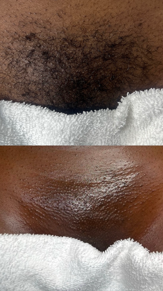 Brazilian Wax