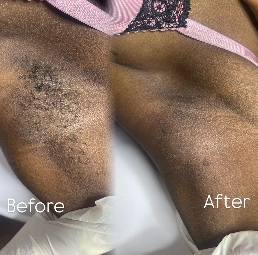 Under Arm Wax