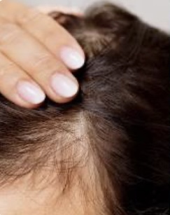 Hair Loss Treatment