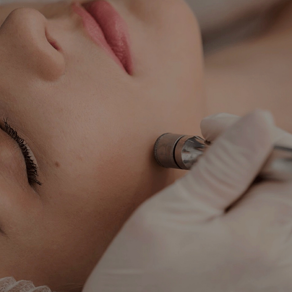 Microderm with Hydrojelly Mask at Sweet Peach Waxing in Helotes, TX