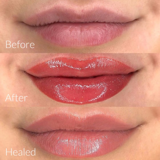 Lip Blushing