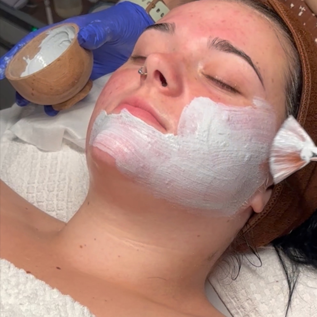 Chemical peel facial at Skin That Hitts in Dade city, FL