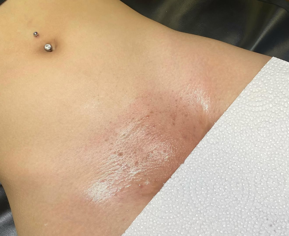 Bikini Line at AYSXBEAUTYBAR in Manteca, CA