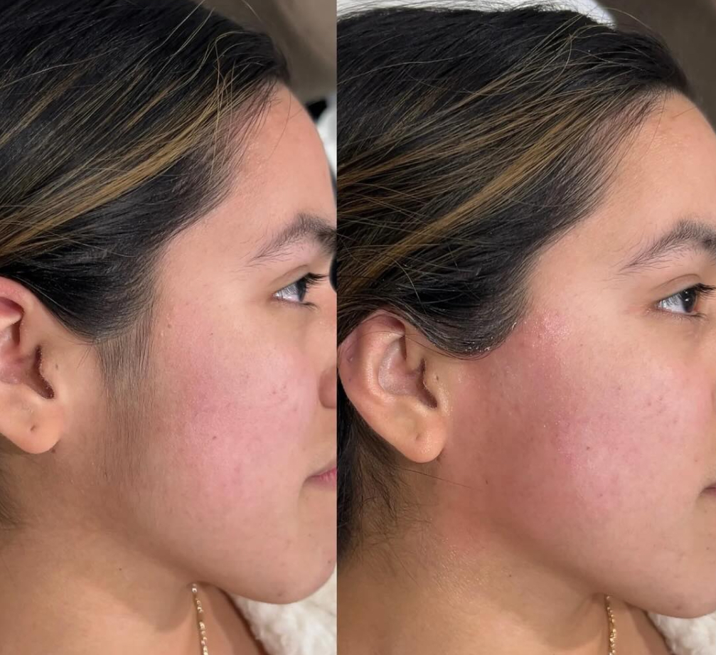 Sideburn Wax/Depilación de Patillo
