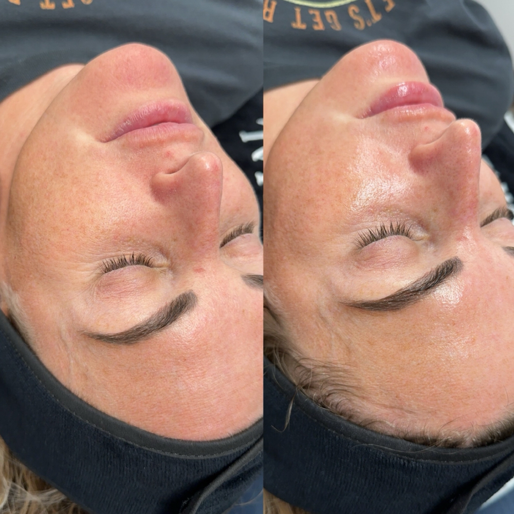 Glo2Facial Delux