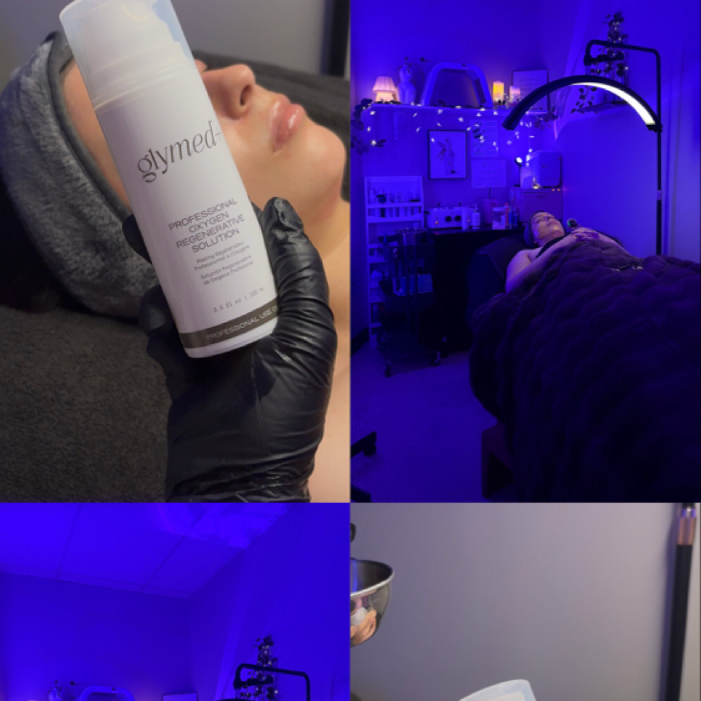 radiant reset + renewal peel ☆⛦ at RADIANT BY DREA in Katy, TX