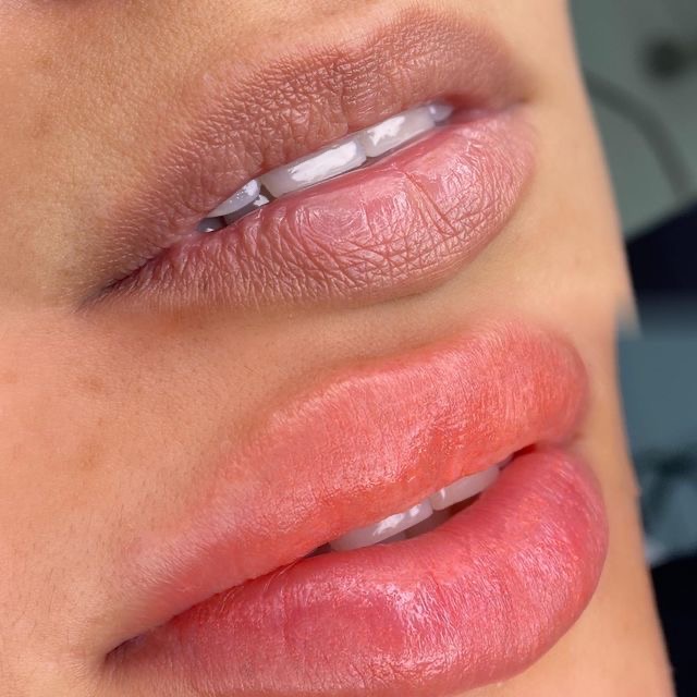 Hydra Lips at La BLANCHE in Morristown, TN