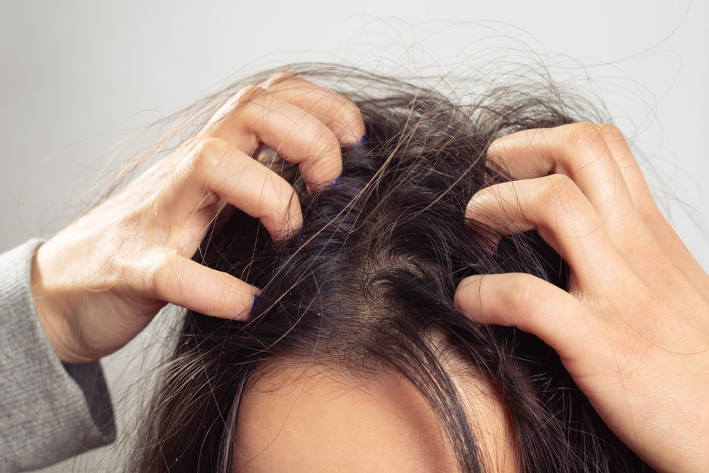 Scalp Treatment