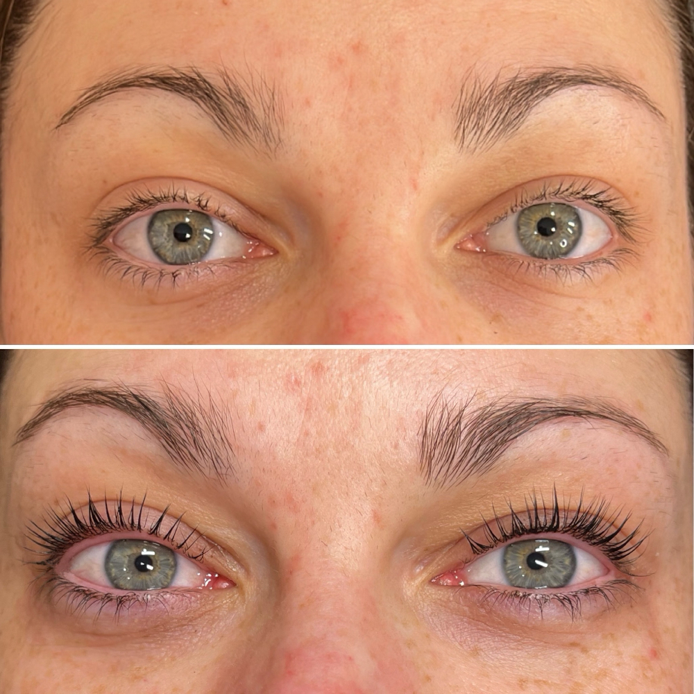 Lash Lift