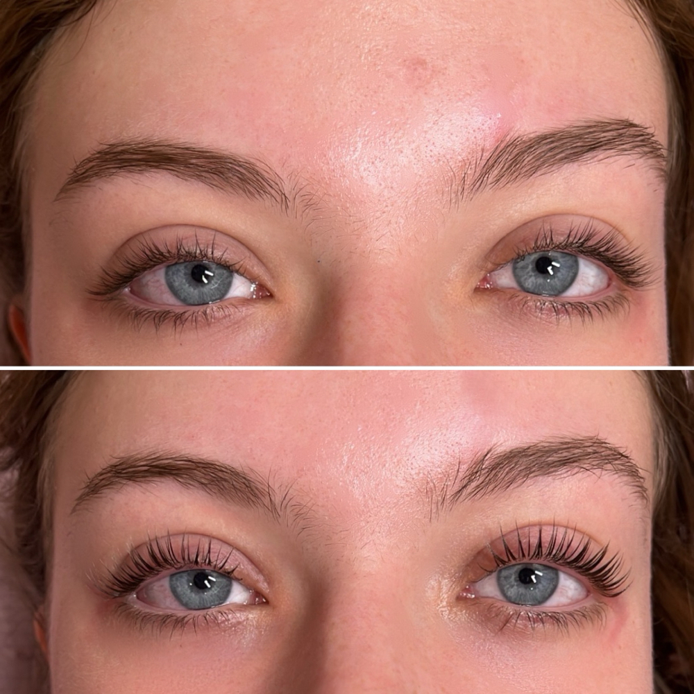 Lash Lift