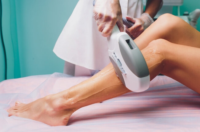 Laser Hair Removal: Full Legs