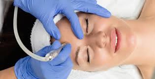 Add-On Microdermabrasion