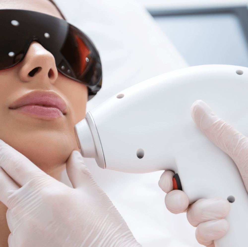 IPL Photo Facial (NY) at Holistic Beauty in View On Website, NY