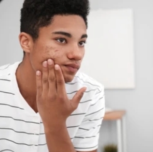 Teen Skin. ( Hidrojelly Mask)