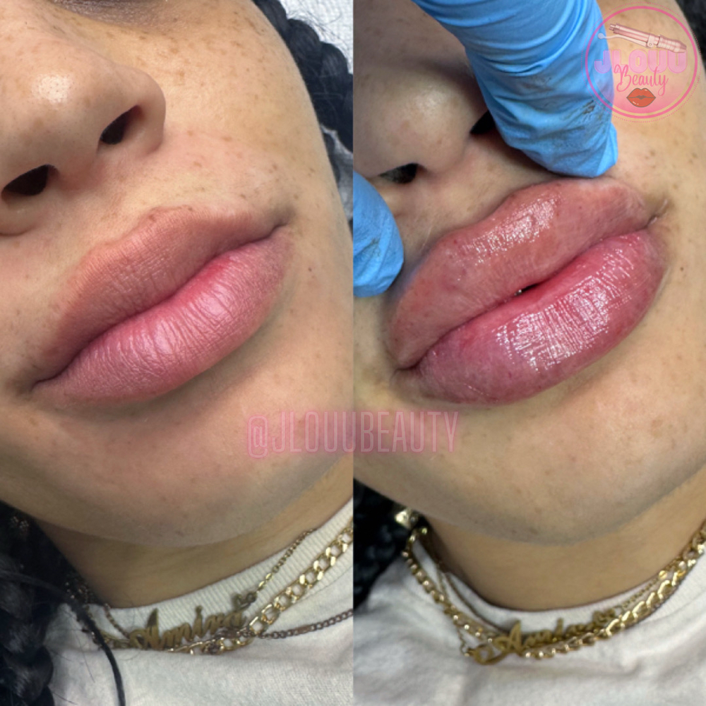 2-4 Week Touch-ups
