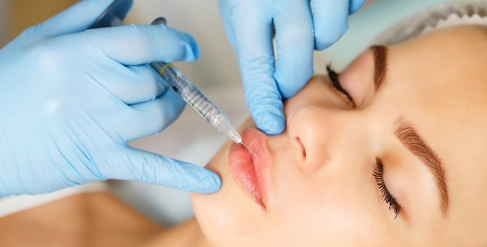 Lip Filler (Full Syringe 1ml)