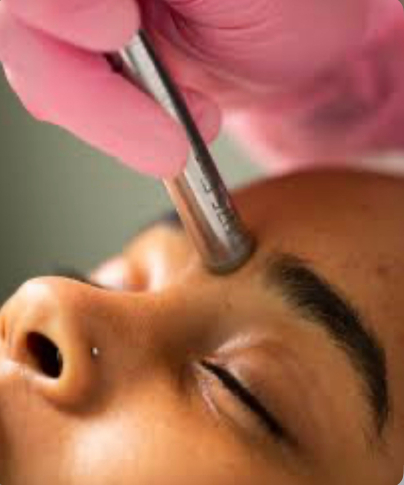 Diamond Microdermabrasion Add On