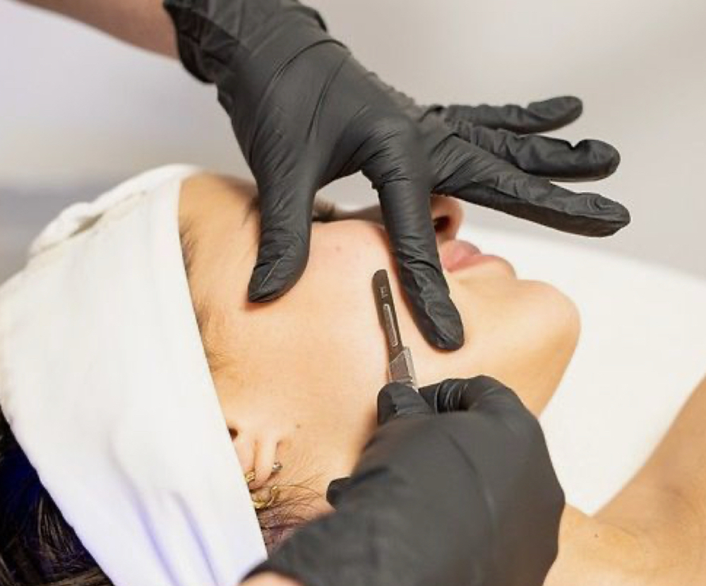 Dermaplane Stand Alone at Hanna Horne Esthetics in Goldsboro, NC