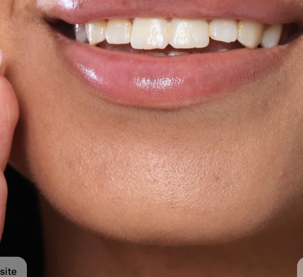 Chin wax at BEAUTYNESS LOUNGE in Aurora, CO