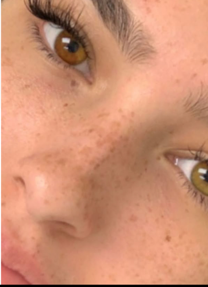 Semi-Permanet Freckles Promo