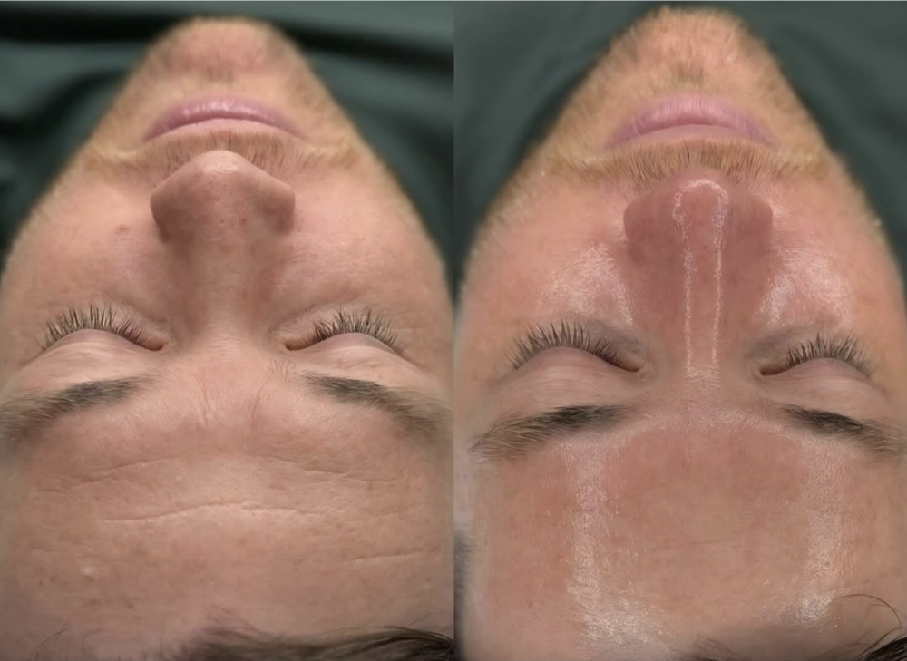 Gentlemen’s Facial