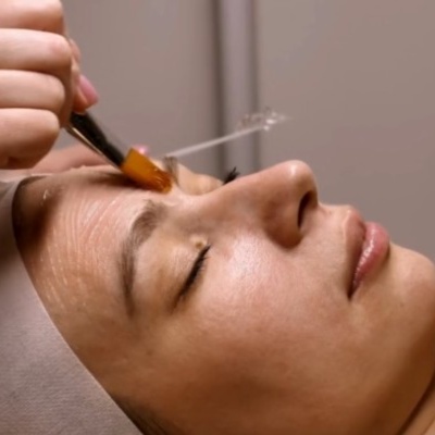 Advanced Peptide Facial
