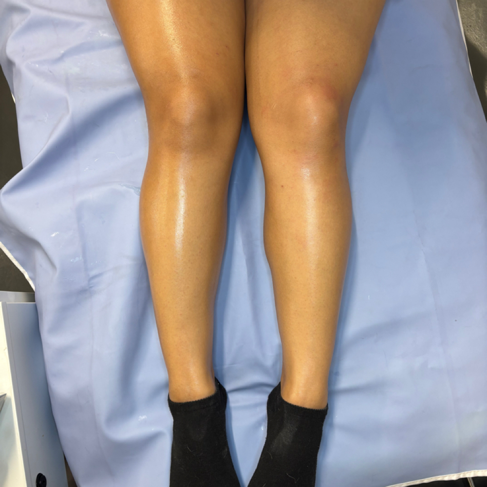 💣 Full Leg Wax at B Bomb Beauty Esthetics in Wichita, KS