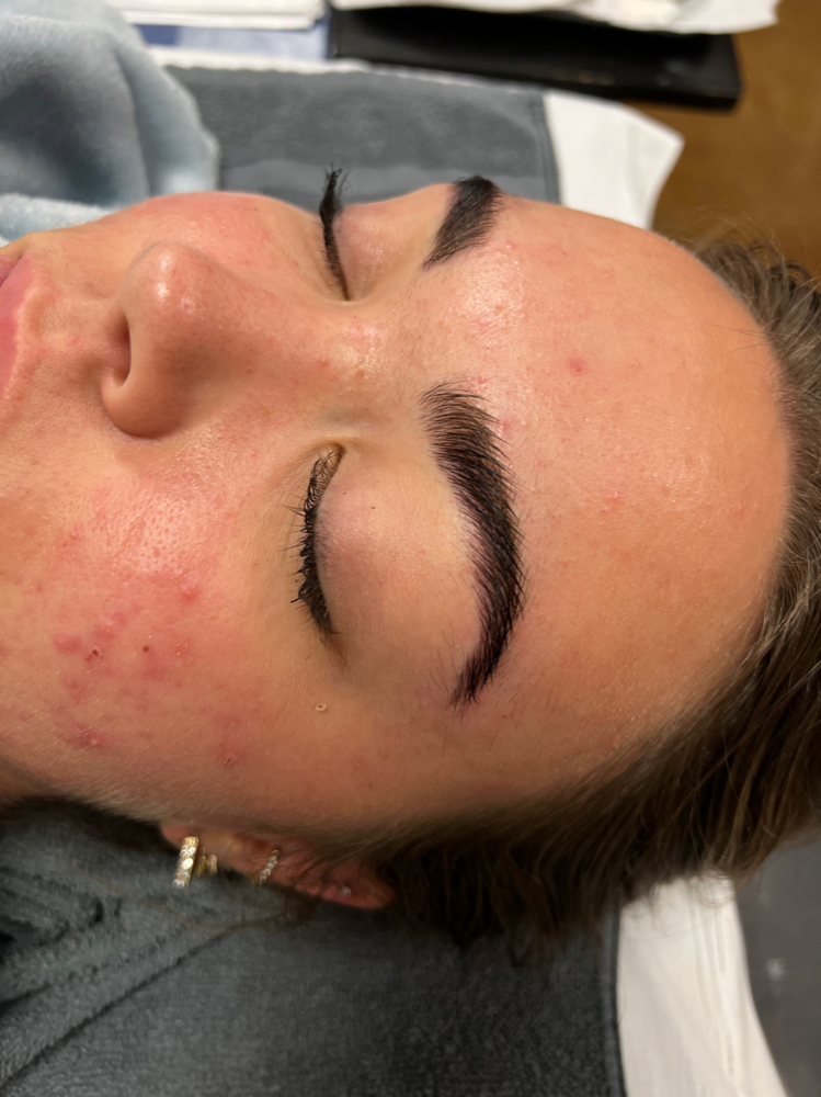 Brow Lamination