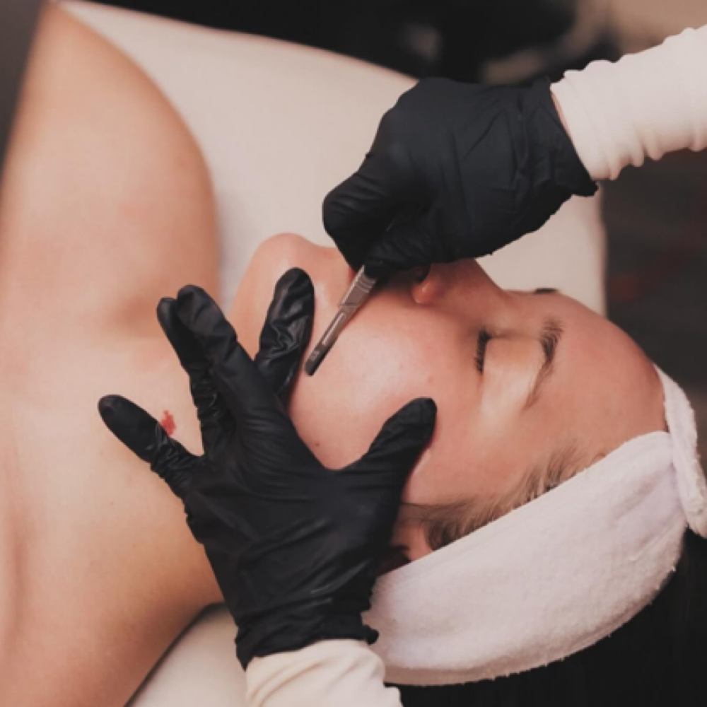 The Renewal (Dermaplane + Chemical at The Skin Lab in Clinton Twp, MI