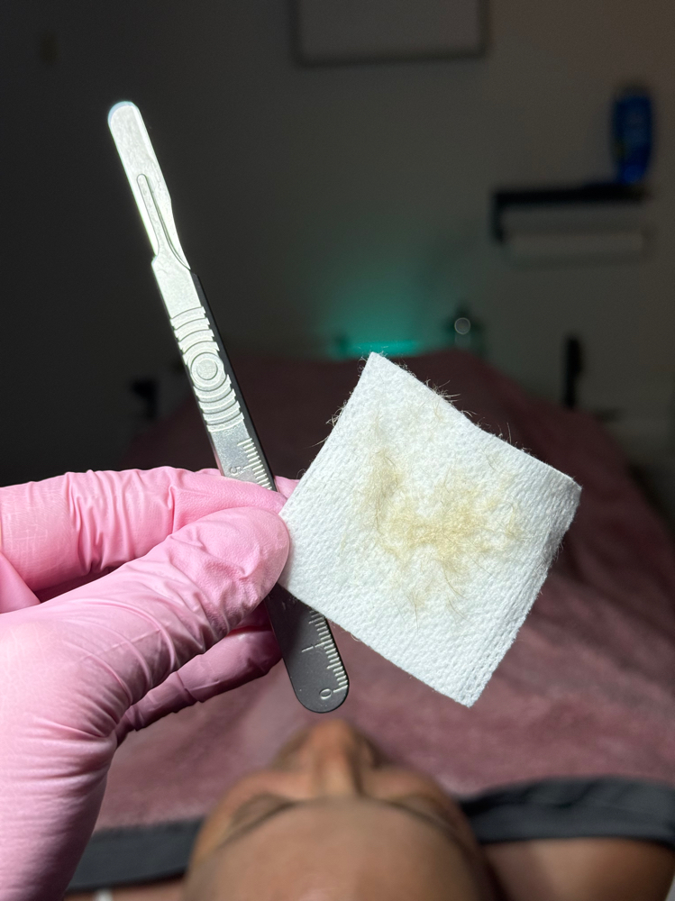 Dermaplane