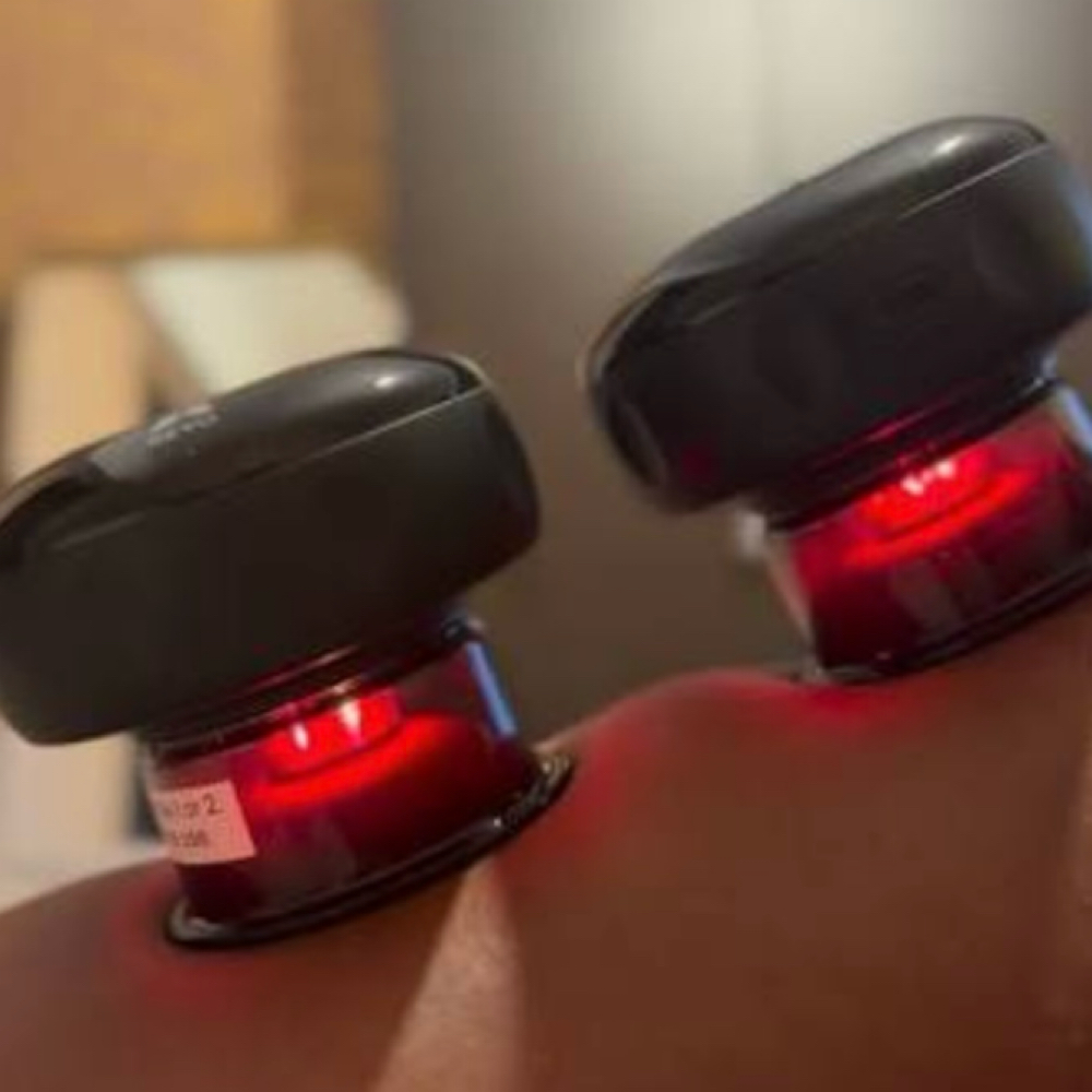 Athlete Recovery Cupping at Radiance Beauty Studio in McAllen, TX